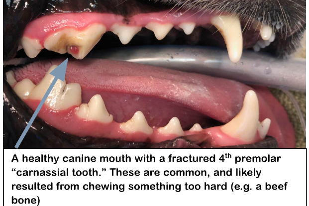A Fractured Canine Premolar