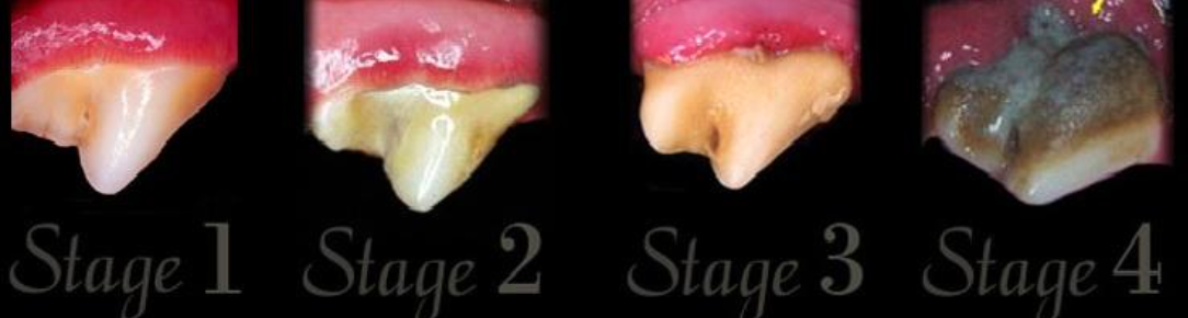 Photos of the Stages of Periodontal Disease on a Dog's Teeth